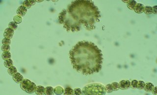 Blauwalg onder de microscoop